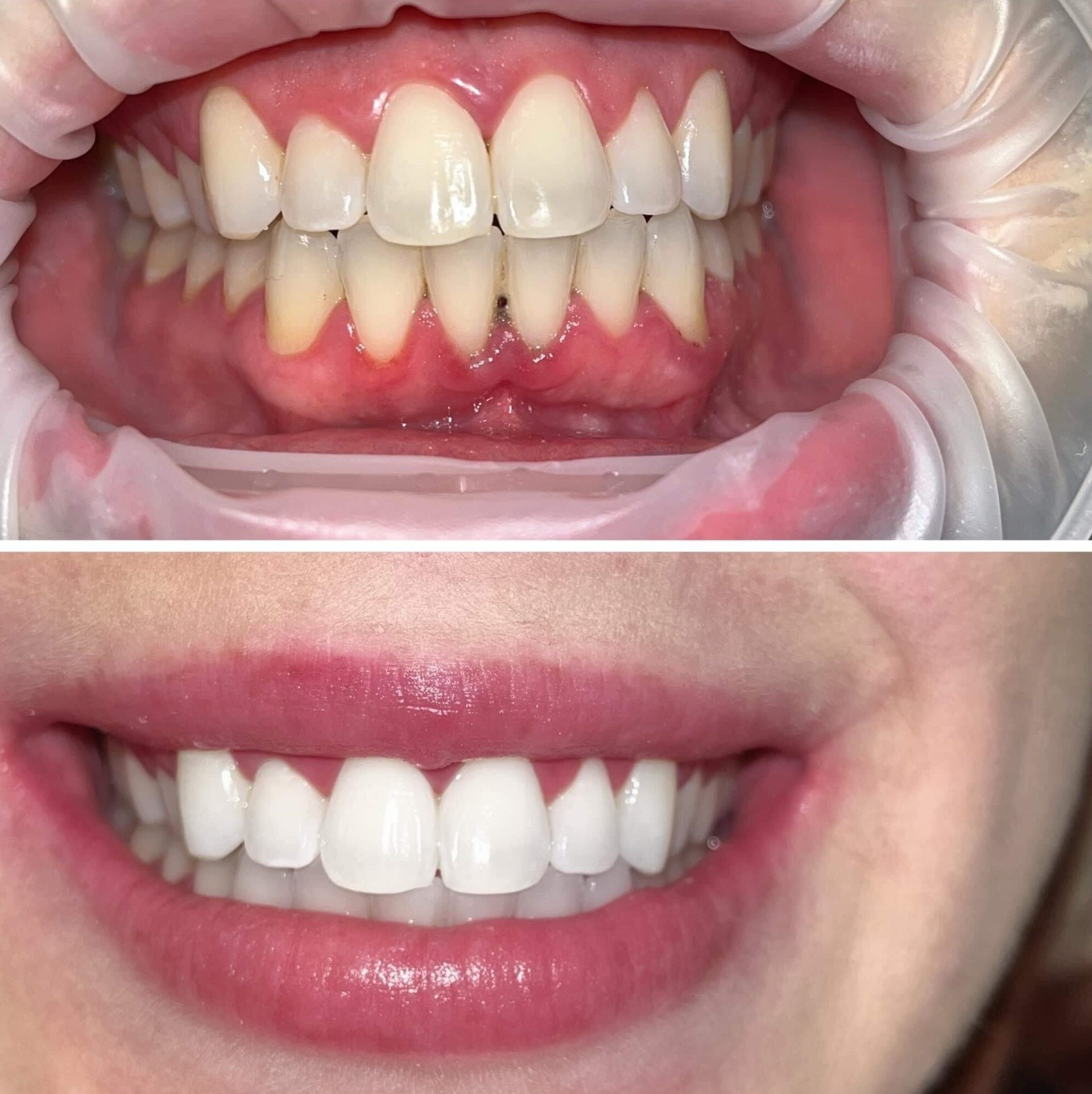 Brow Lamination in Birmingham, AL Lash & Brow Beauty Bar