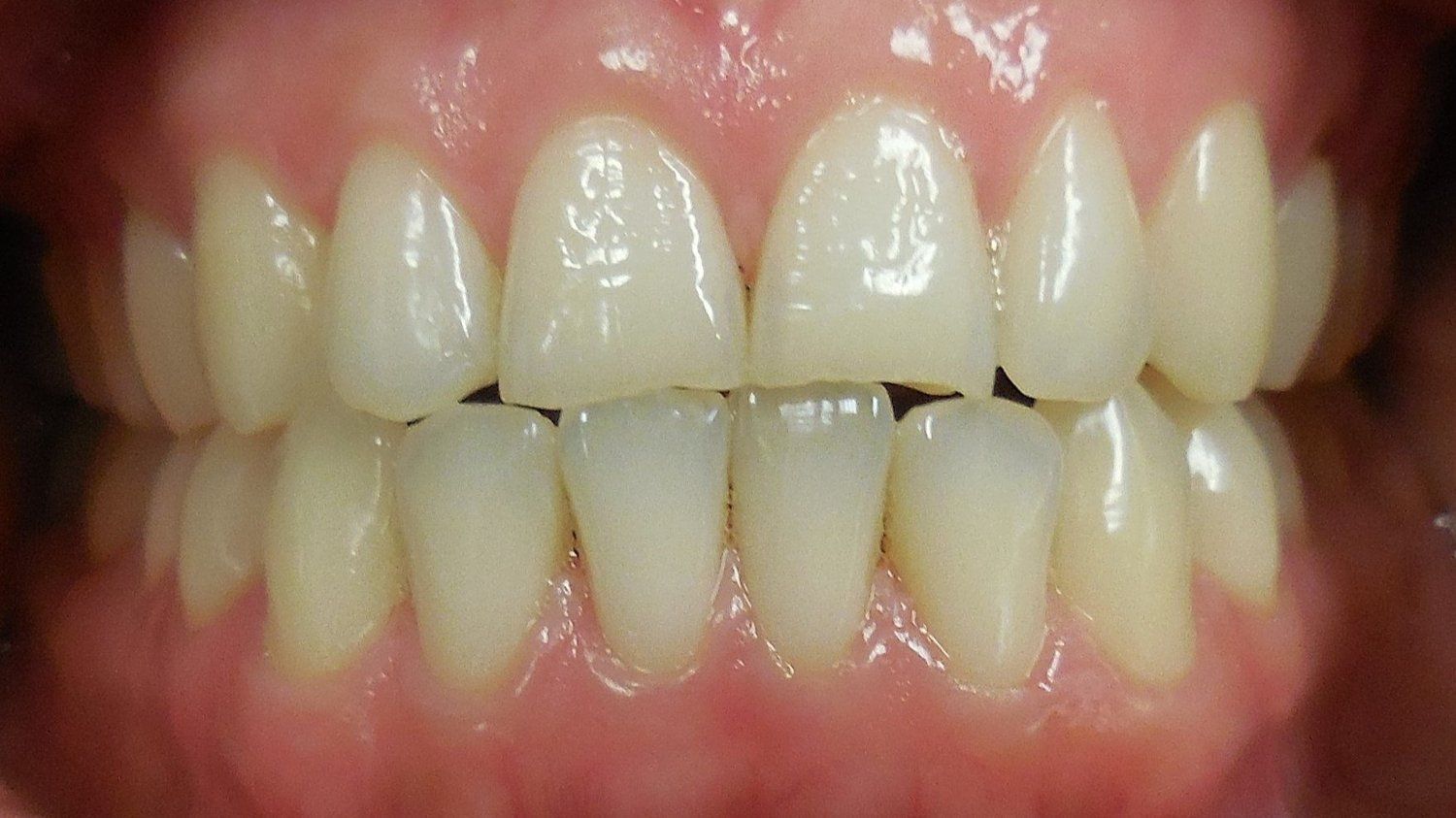 Before and after image 