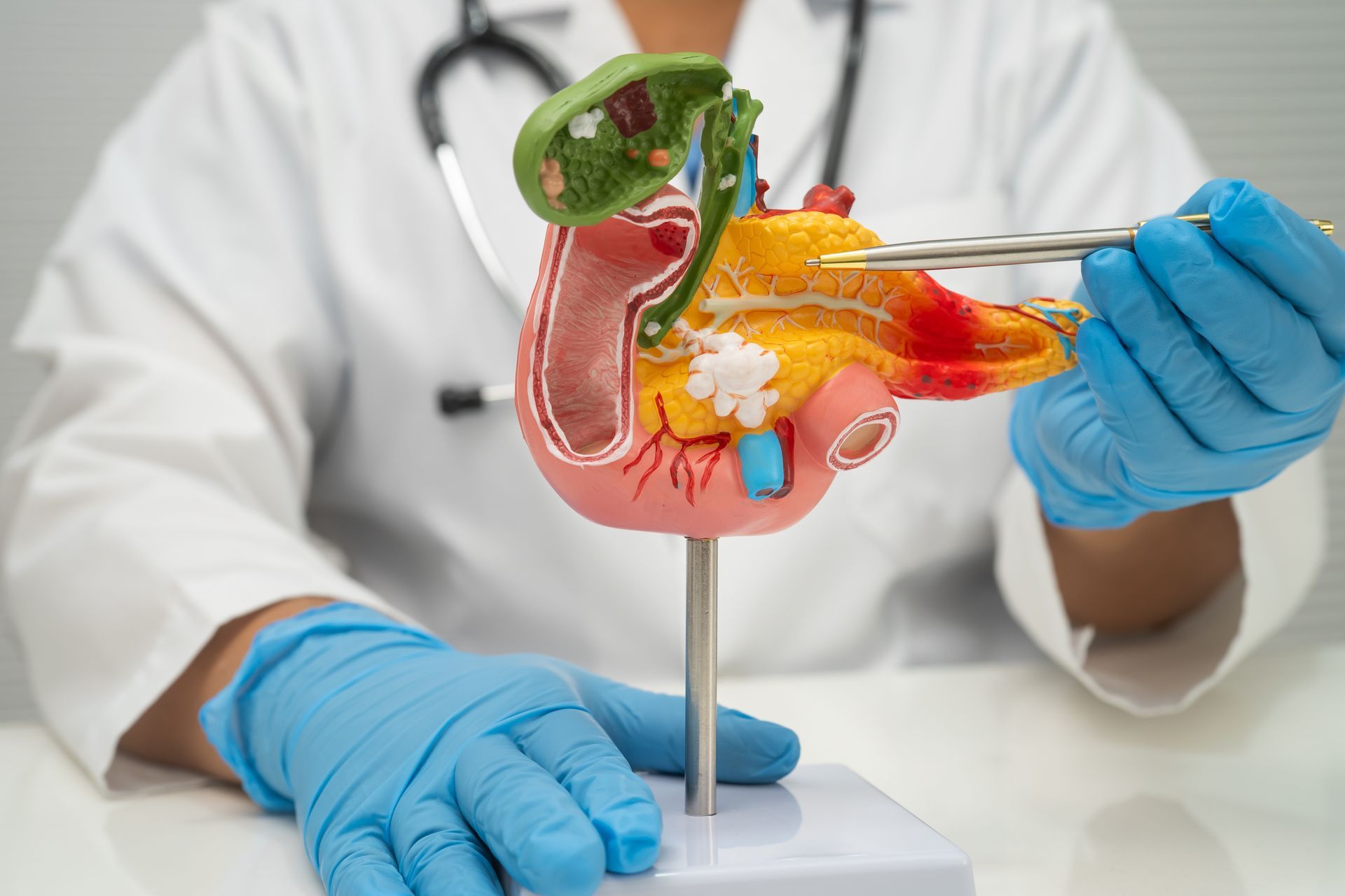 Cirurgia da Vesícula