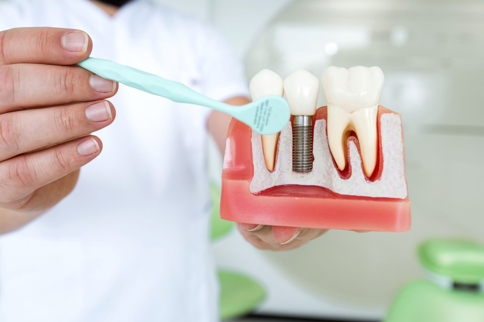 A dentist pointing to a model of a dental implant and teeth. 