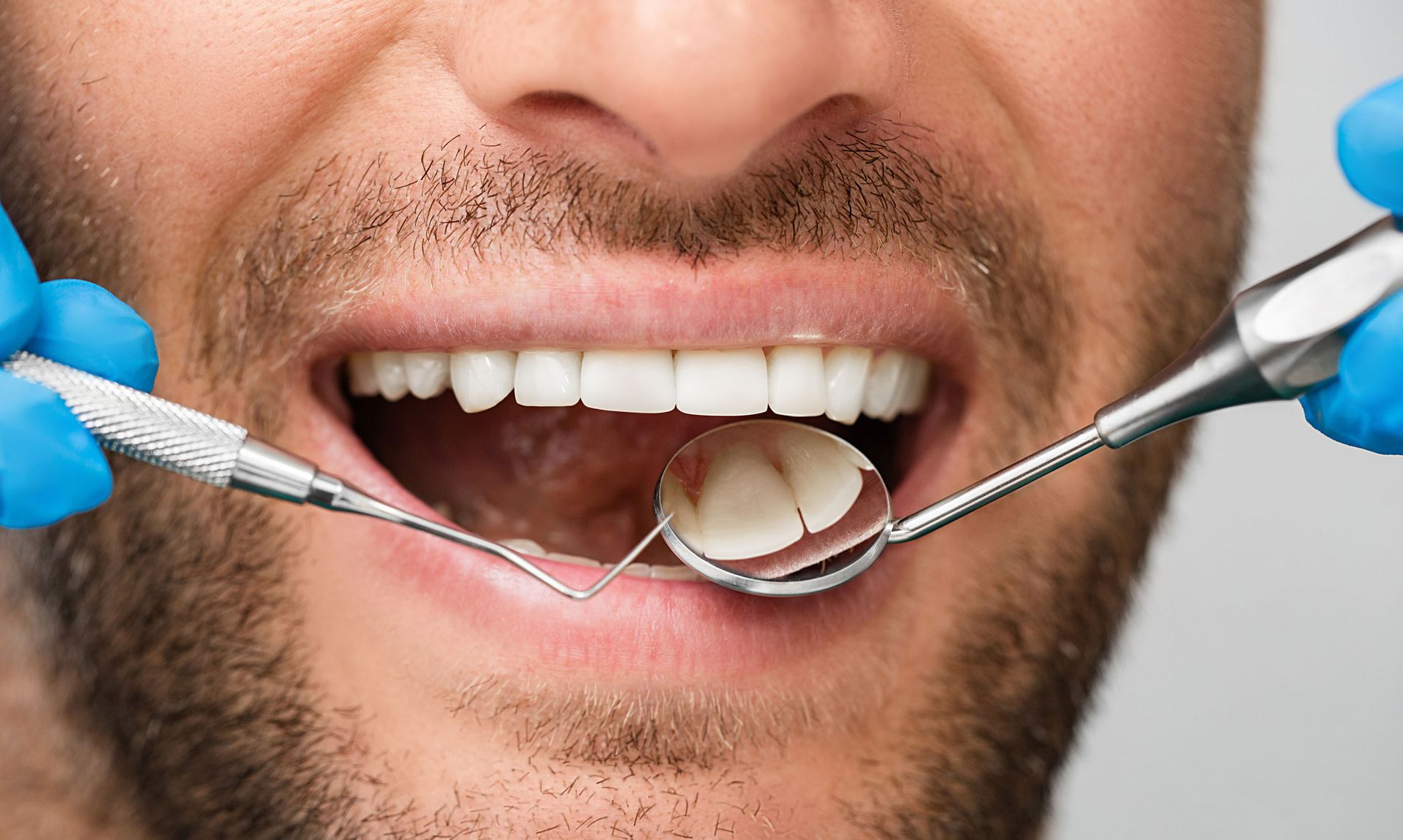 A dentist examining a patient's open mouth with dental tools, including a mirror.