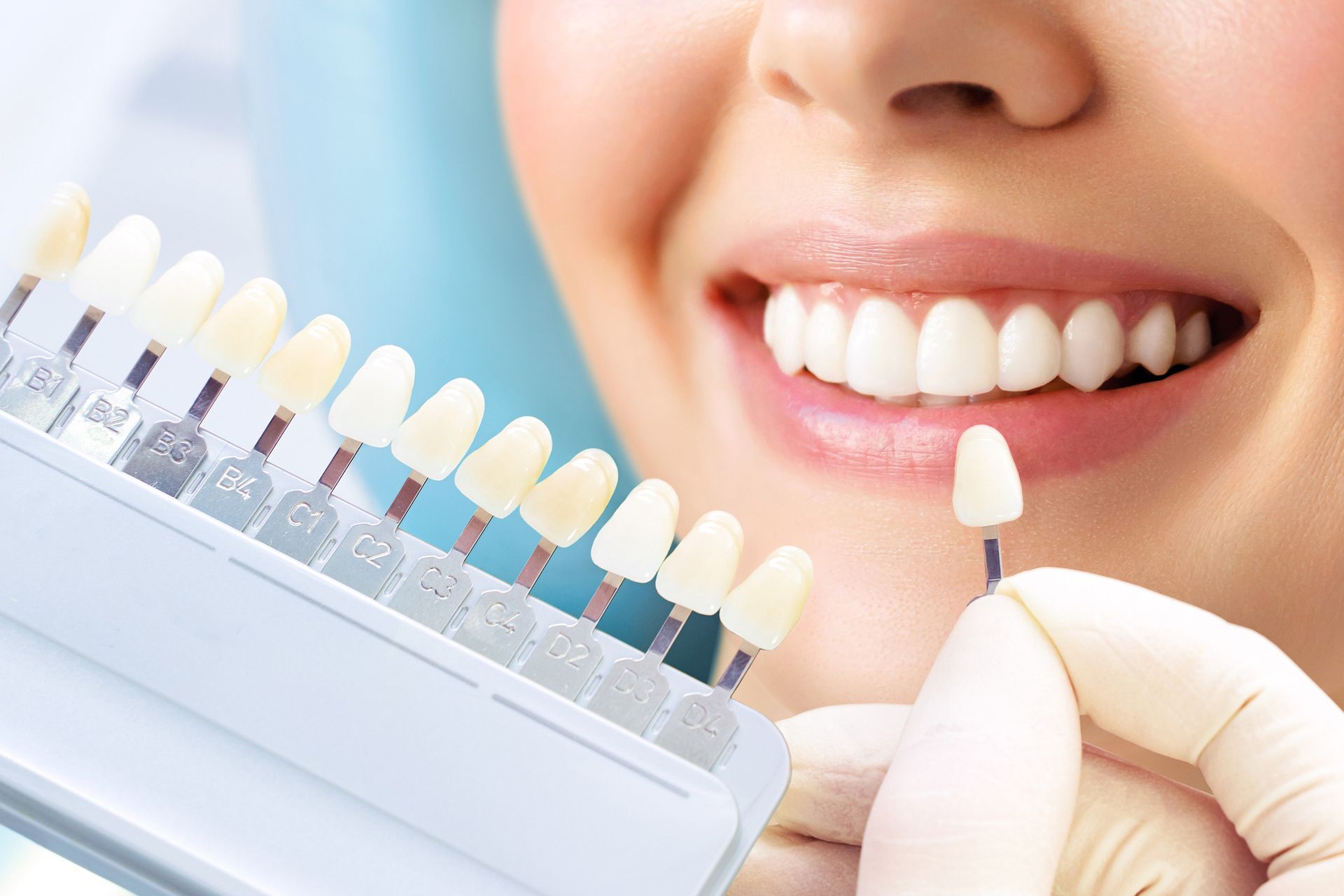 Woman's smile comparing tooth shade with a color guide.