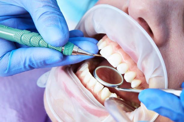 Hands in blue gloves with tools, mouth open, teeth visible, dental mirror in use.