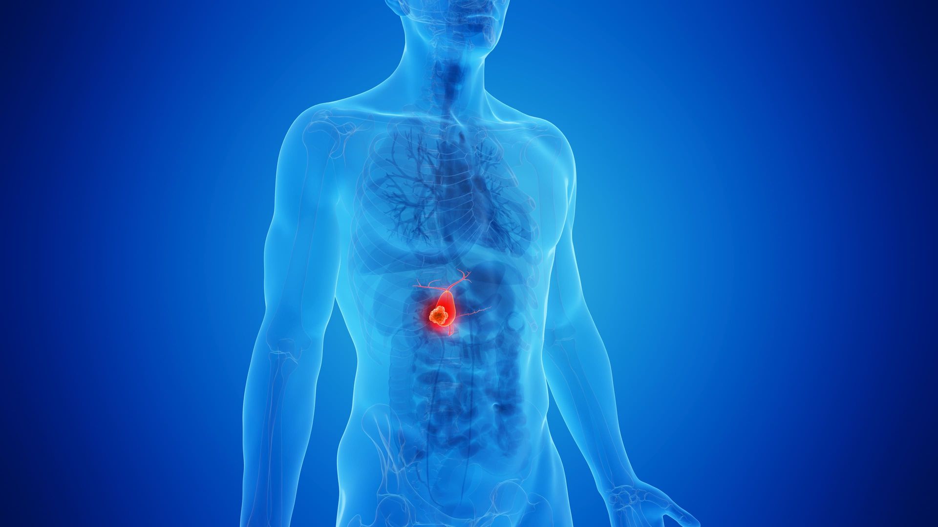 Torso humano azul com um destaque vermelho brilhante na região do estômago.