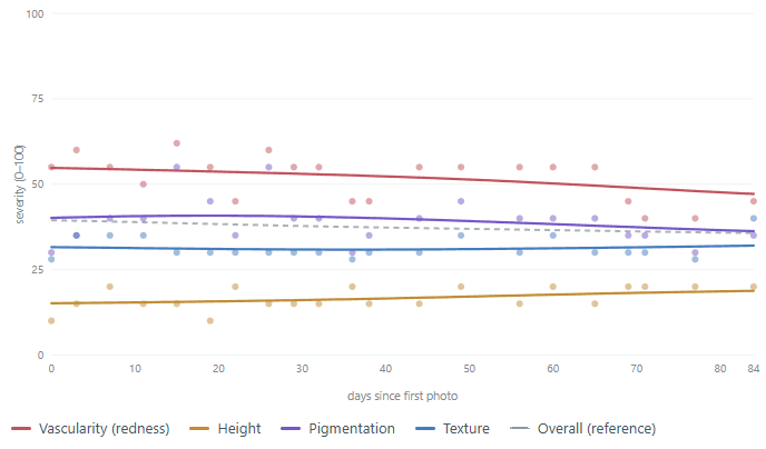 Line chart of Scar Scores from 0 to 100 for vascularity (redness), height, pigmentation and texture, plus an overall score, for every photo in record F_C Section_1Y_30s from day 0 to day 84.