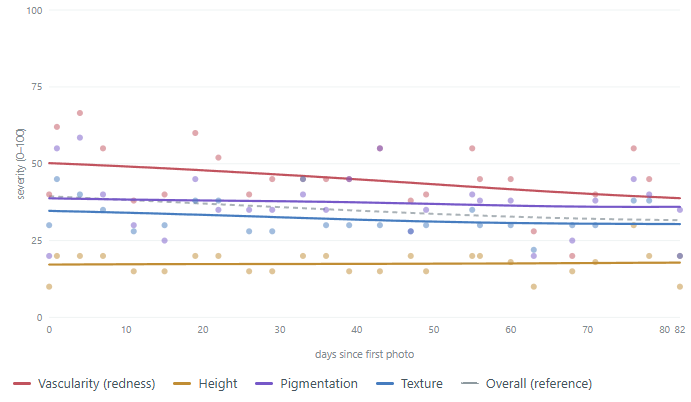 Line chart of Scar Scores from 0 to 100 for vascularity (redness), height, pigmentation and texture, plus an overall score, for every photo in record F_Surgical_15Y_30s from day 0 to day 82.