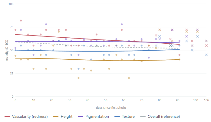 Line chart of Scar Scores from 0 to 100 for vascularity (redness), height, pigmentation and texture, plus an overall score, for every photo in record F_Surgical_1Y_40s from day 0 to day 106.
