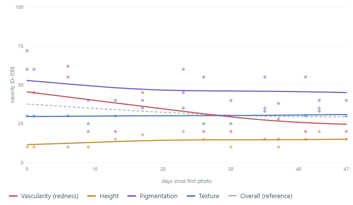 Line chart of Scar Scores from 0 to 100 for vascularity (redness), height, pigmentation and texture, plus an overall score, for every photo in record F_Surgical_1Y_50s from day 0 to day 47.
