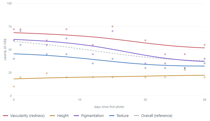 Line chart of Scar Scores from 0 to 100 for vascularity (redness), height, pigmentation and texture, plus an overall score, for every photo in record M_Surgical_10Y_30s from day 0 to day 29.