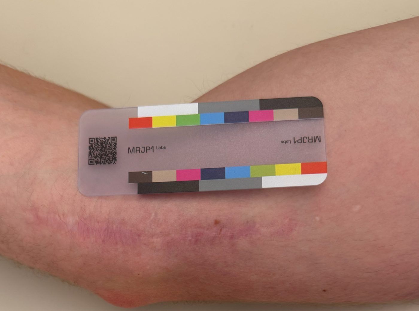 Participant photo, day 28, September 17, 2026: the same scar.
