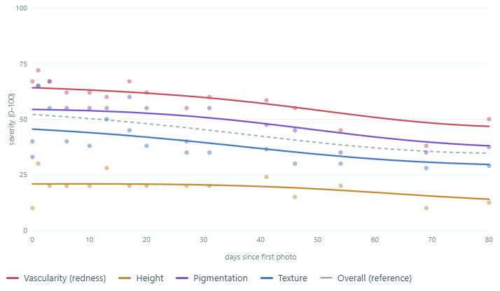 Line chart of Scar Scores from 0 to 100 for vascularity (redness), height, pigmentation and texture, plus an overall score, for every photo in record M_Trauma_1Y_30s from day 0 to day 80.