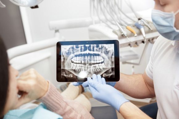 radiografia