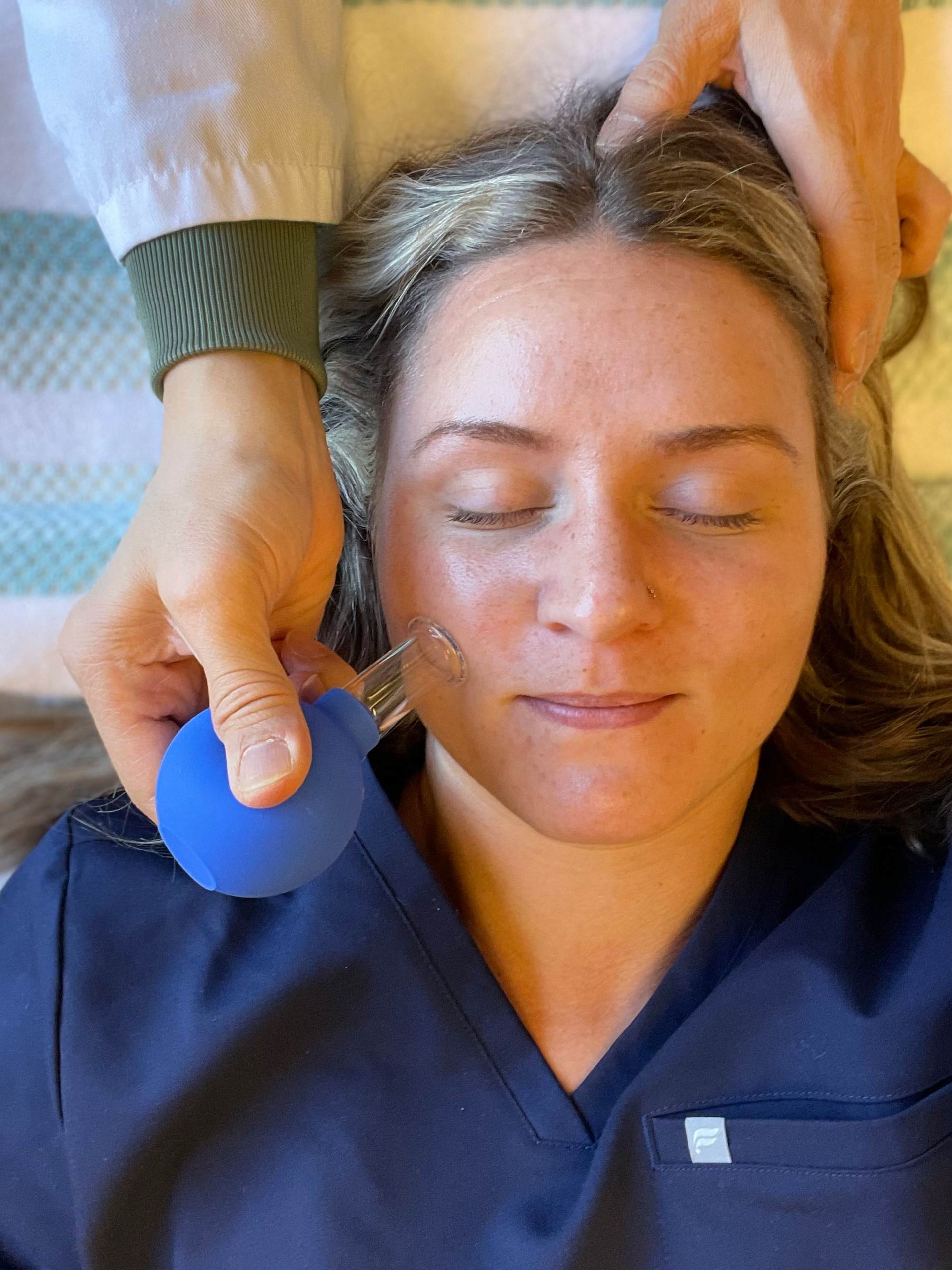 Facial cupping — Vancouver, WA — Vancouver Acupuncture