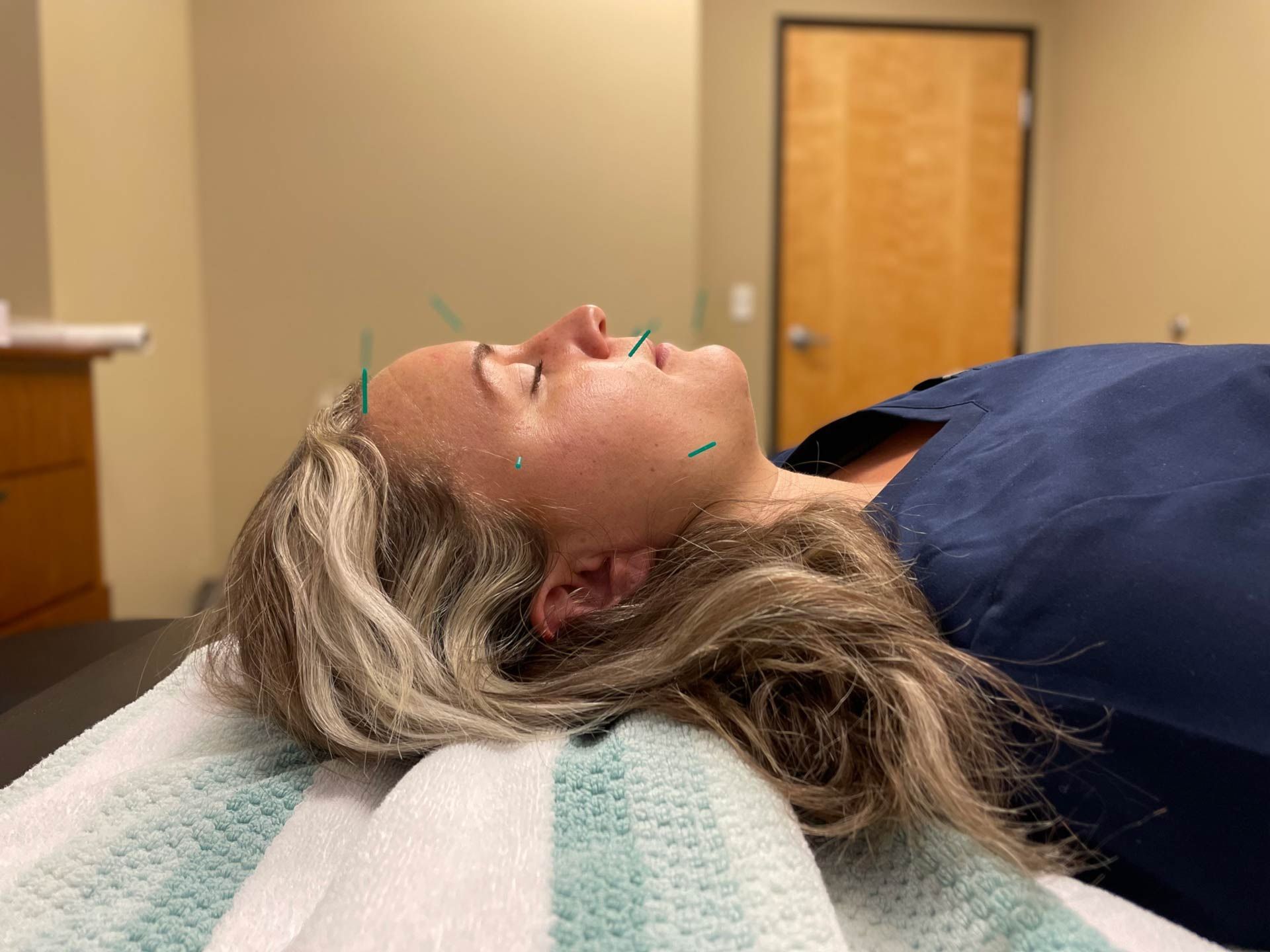 Facial Guasha — Vancouver, WA — Vancouver Acupuncture