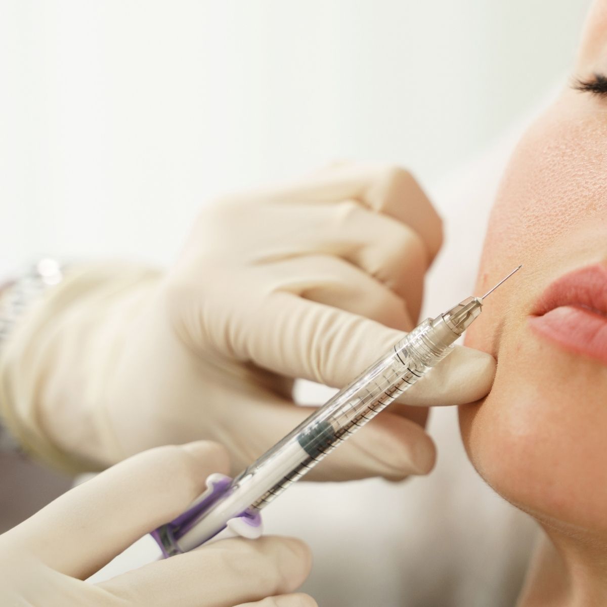 Dermal filler treatment in Hewitt, TX