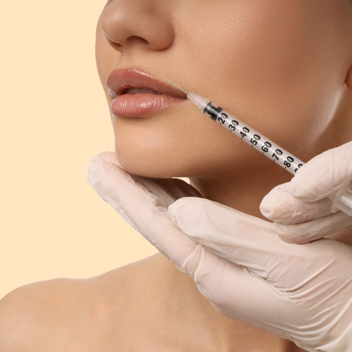 Dermal filler treatment in Hewitt, TX