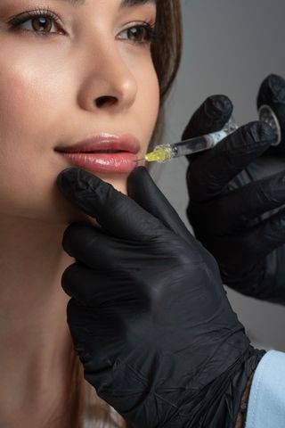 Close-up of lip filler injection on a woman's lips by a gloved clinician