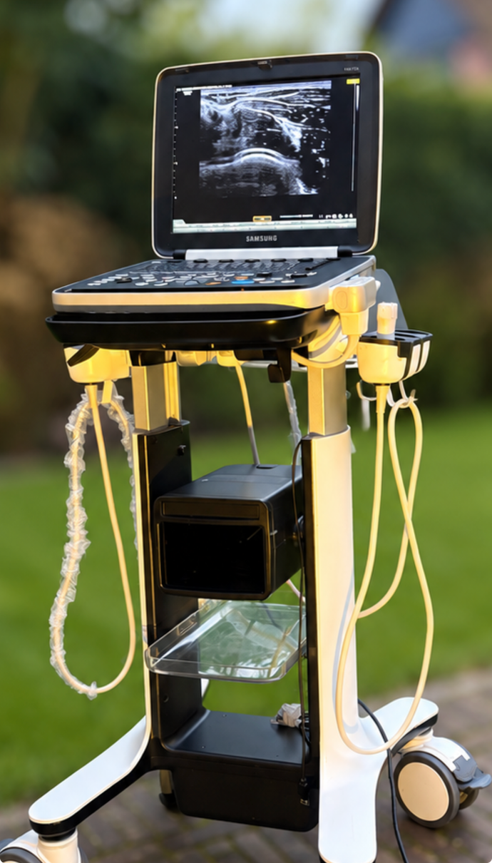 Draagbaar echografieapparaat op een verrijdbaar karretje met een laptopscherm waarop een scan wordt weergegeven.
