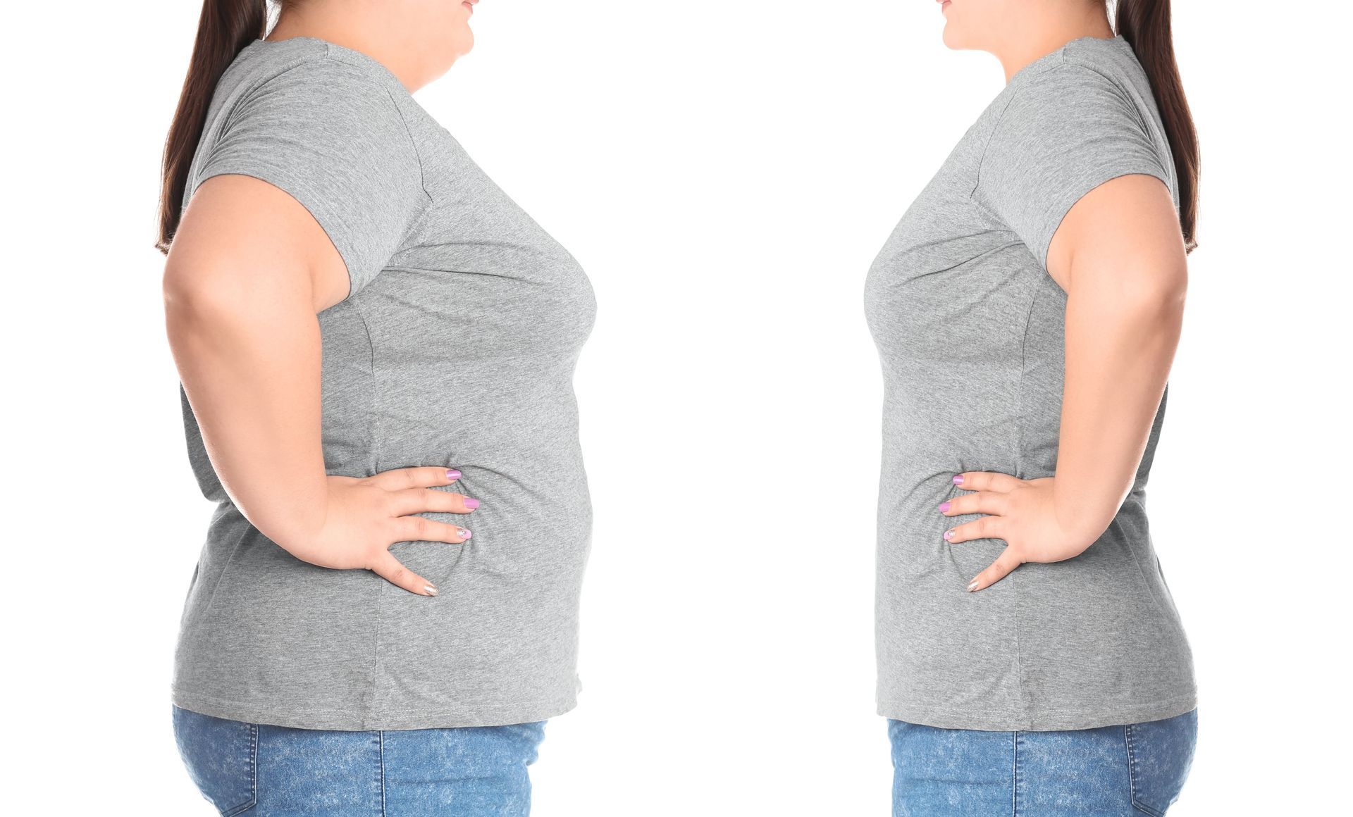 Obesidade e Doenças Metabólicas