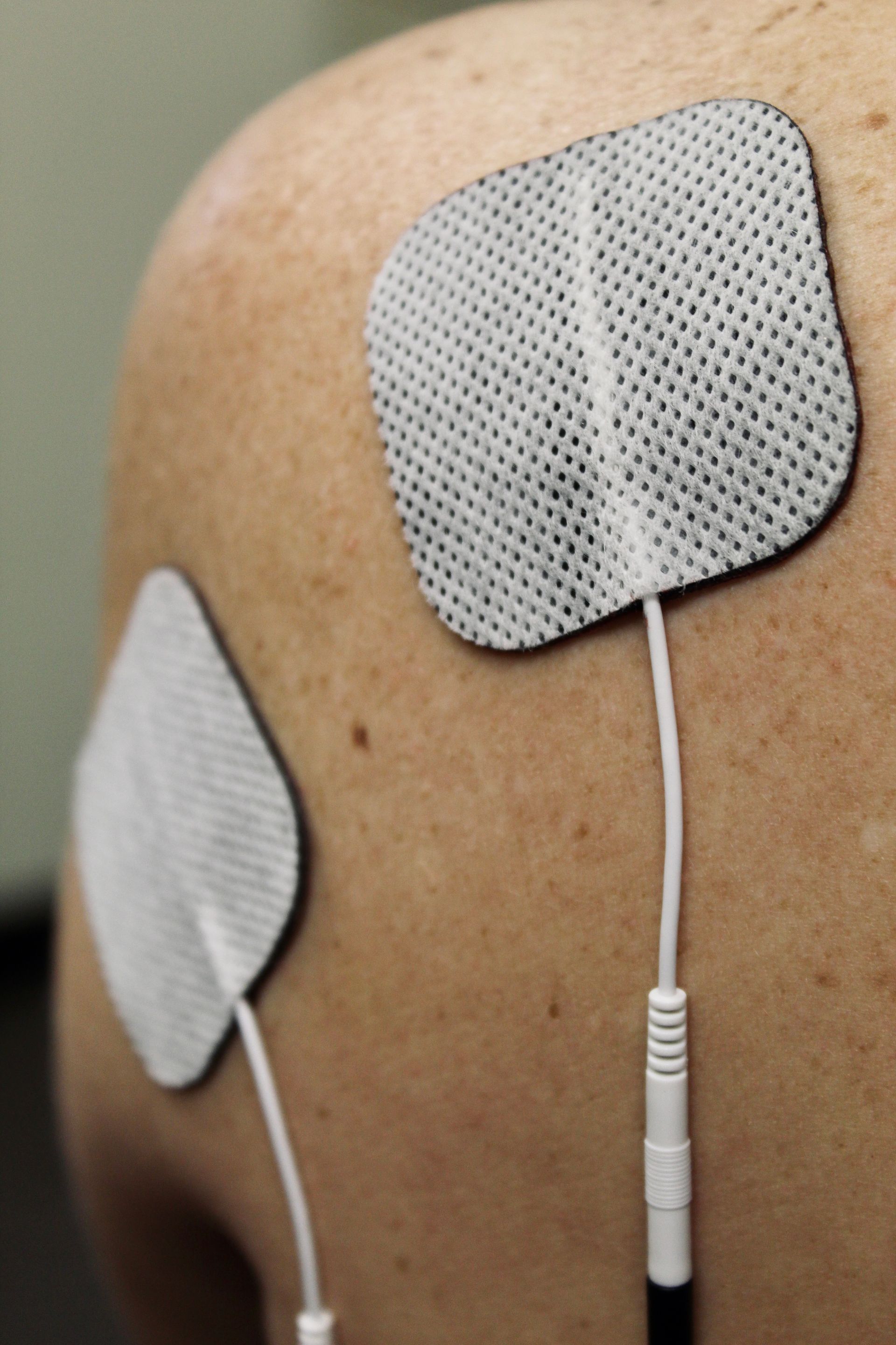 TENS electrode pads on back. 