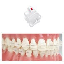 brackets in ceramica 