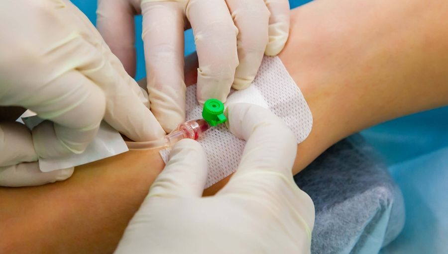sedazione endovenosa 
