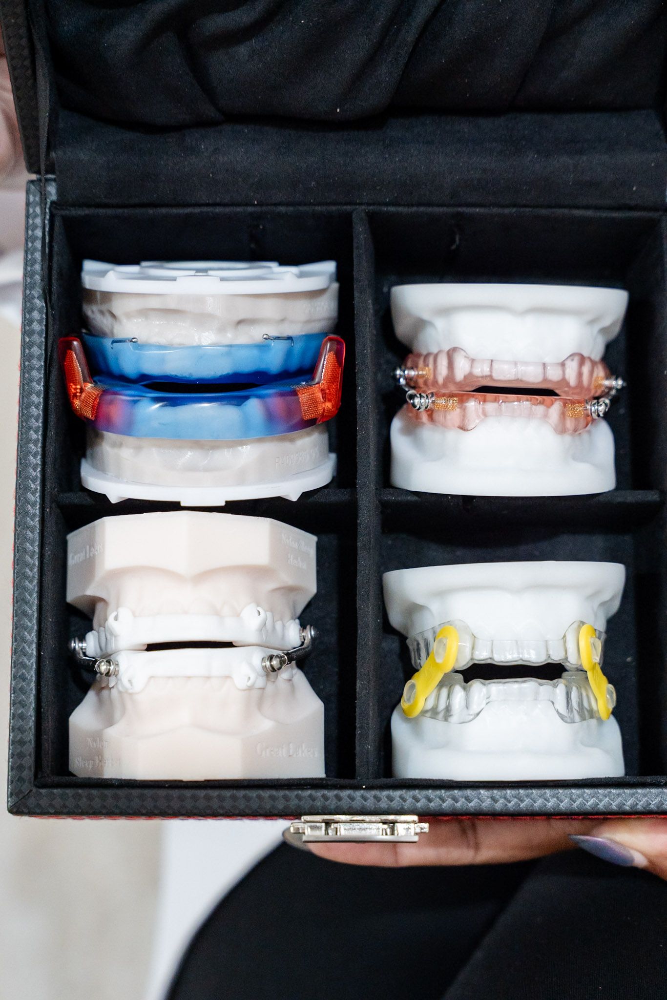 Open case with four rows of dental aligners in blue, copper, white, and yellow bands