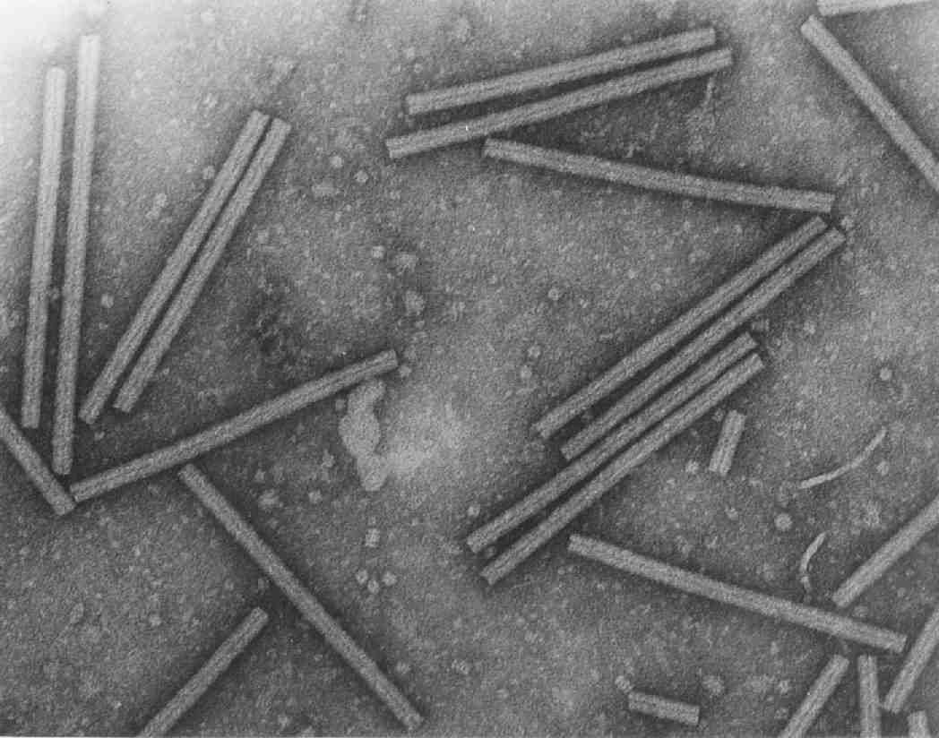 Microscopisch beeld in grijstinten van verspreide staafvormige deeltjes op een gestructureerde achtergrond.