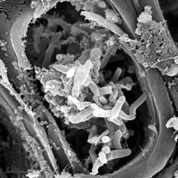 Zwart-wit microscopische close-up van kristallijn puin en vezels in een cirkelvormige holte.