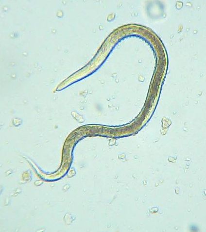 Microscopische weergave van een wormachtige parasiet op een bleke achtergrond.