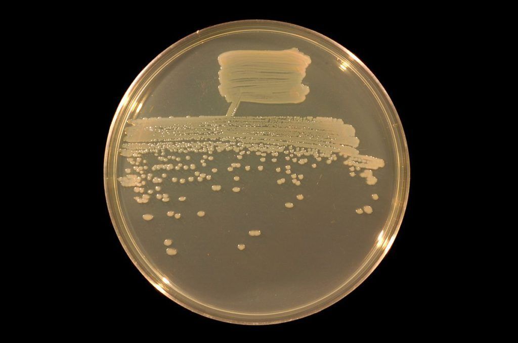 Petrischaal met beige bacteriekolonies die groeien op agar onder warm licht.