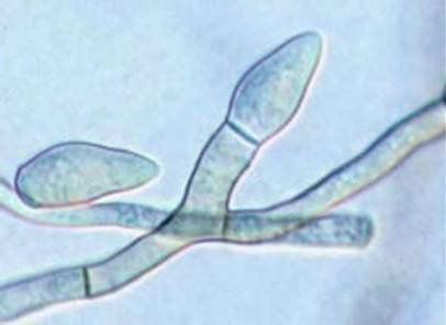 Microscopische weergave van blauwgroene schimmelsporen en vertakkende hyfen op een lichte achtergrond.