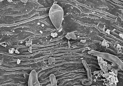 Scanning elektronenmicroscoo