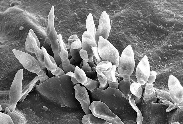 Microscopisch kleine grijze schimmelsporen, samengeklonterd op een gestructureerd oppervlak.