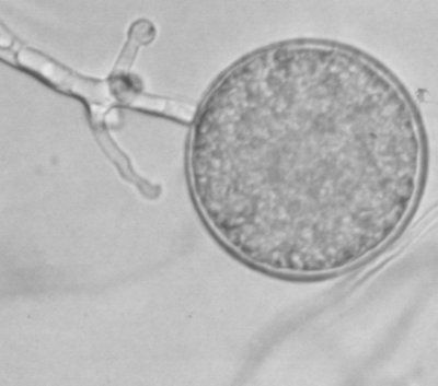 Microscopisch beeld van een ronde, gestructureerde cel die vastzit aan een vertakkend filament.