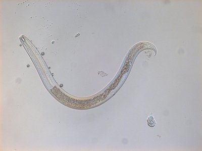 Microscopische weergave van een slank, doorschijnend wormachtig organisme op een bleke achtergrond.