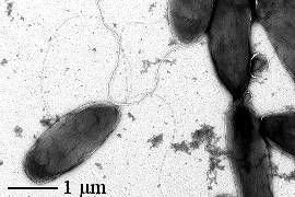Microscopische afbeelding van meerdere donkere staafvormige cellen op een lichte achtergrond, met een schaalbalk van 1 µm.