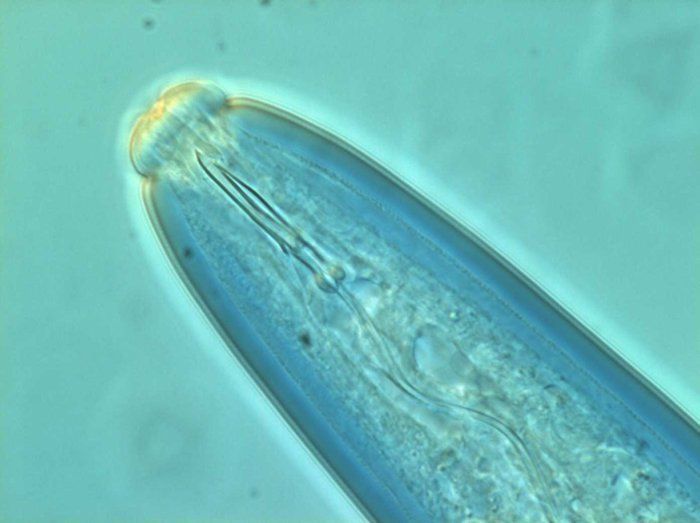 Close-up van een klein blauwgroen waterorganisme onder een microscoop.
