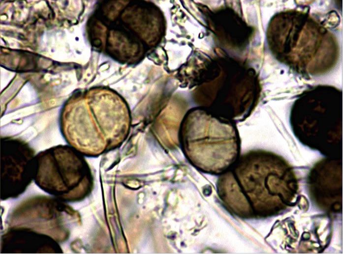 Microscopische weergave van ronde, bruine sporen of stuifmeelkorrels verspreid tussen witte vezels.