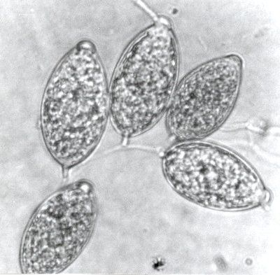 Microscopische weergave van vijf ovale, doorschijnende eencellige organismen met een korrelige binnenkant.