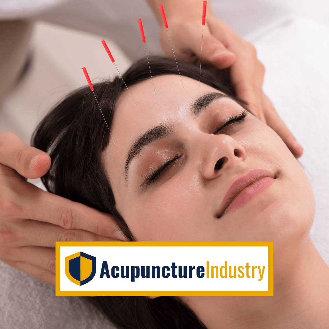 Accpuncture Industry