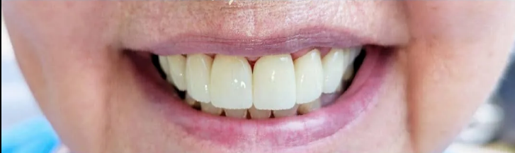 A close up of a person 's teeth and lips.