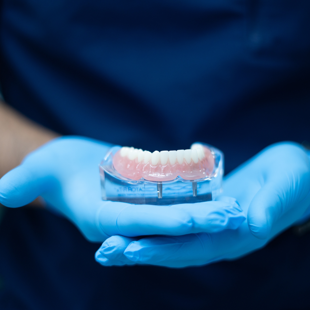 A person wearing blue gloves is holding a model of teeth.