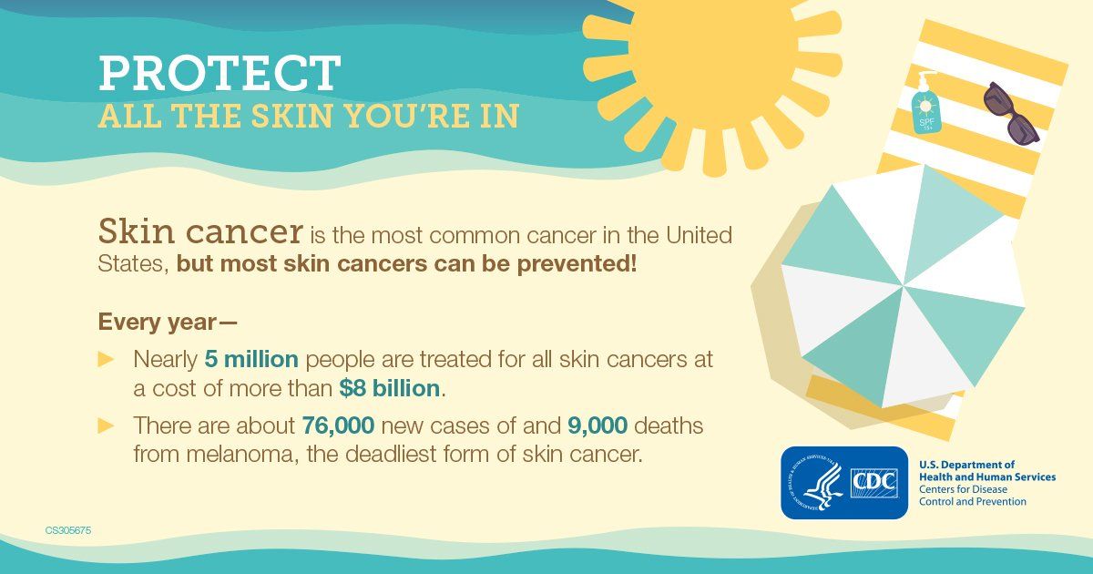Skin Cancer Infographics — Shelby Township, MI — Dermatology Specialists of Shelby Township Skin Cancer Infographics — Shelby Township, MI — Dermatology Specialists of Shelby Township