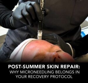 Person receiving a microneedling treatment on their face.