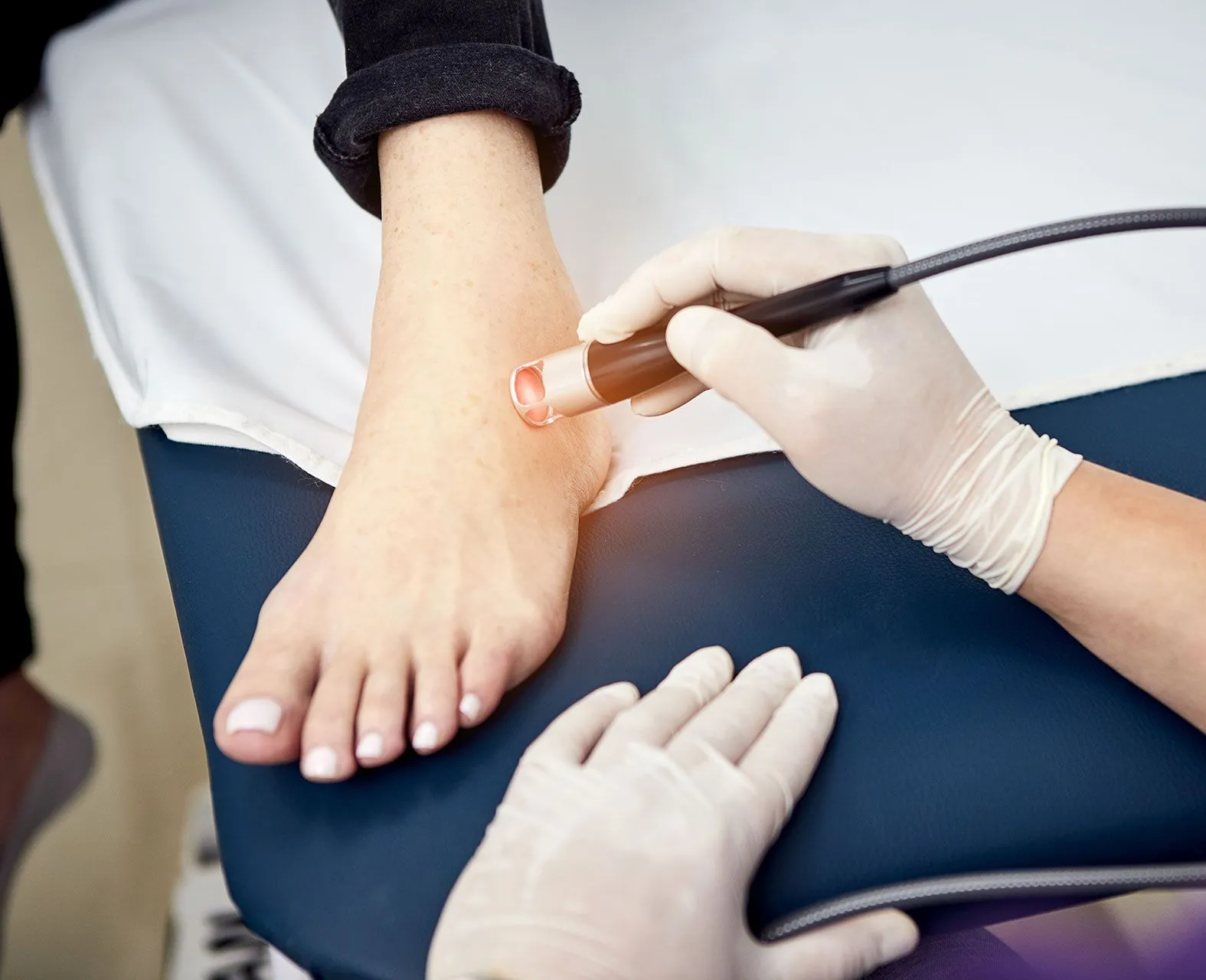 A person receiving laser therapy on their ankle, held by a person wearing gloves on a blue table.