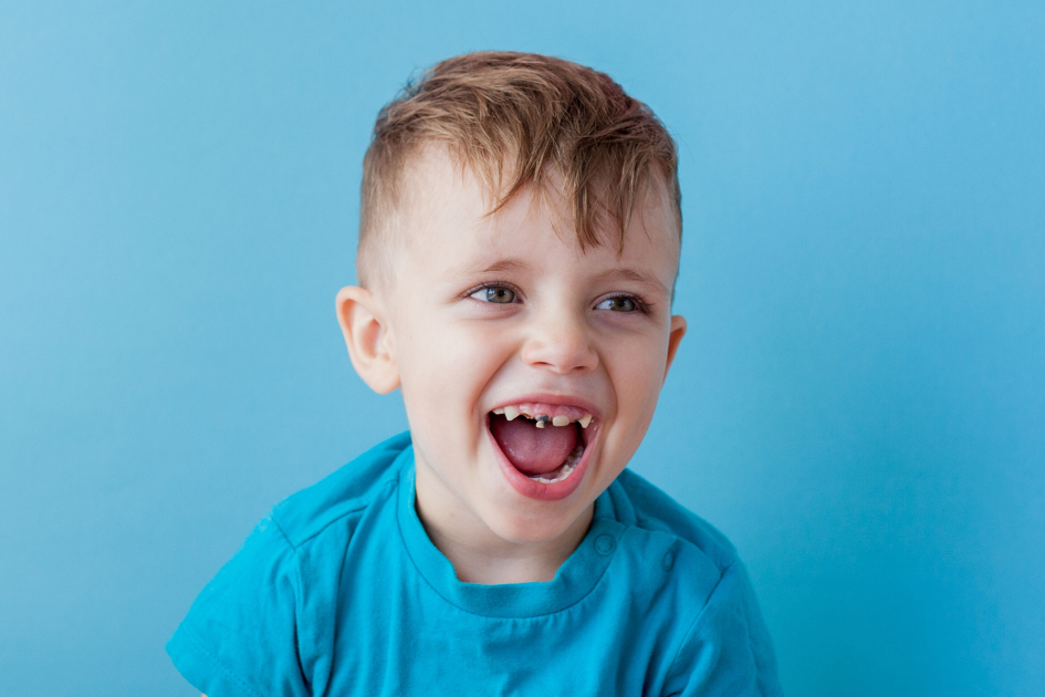 Tooth decay in children