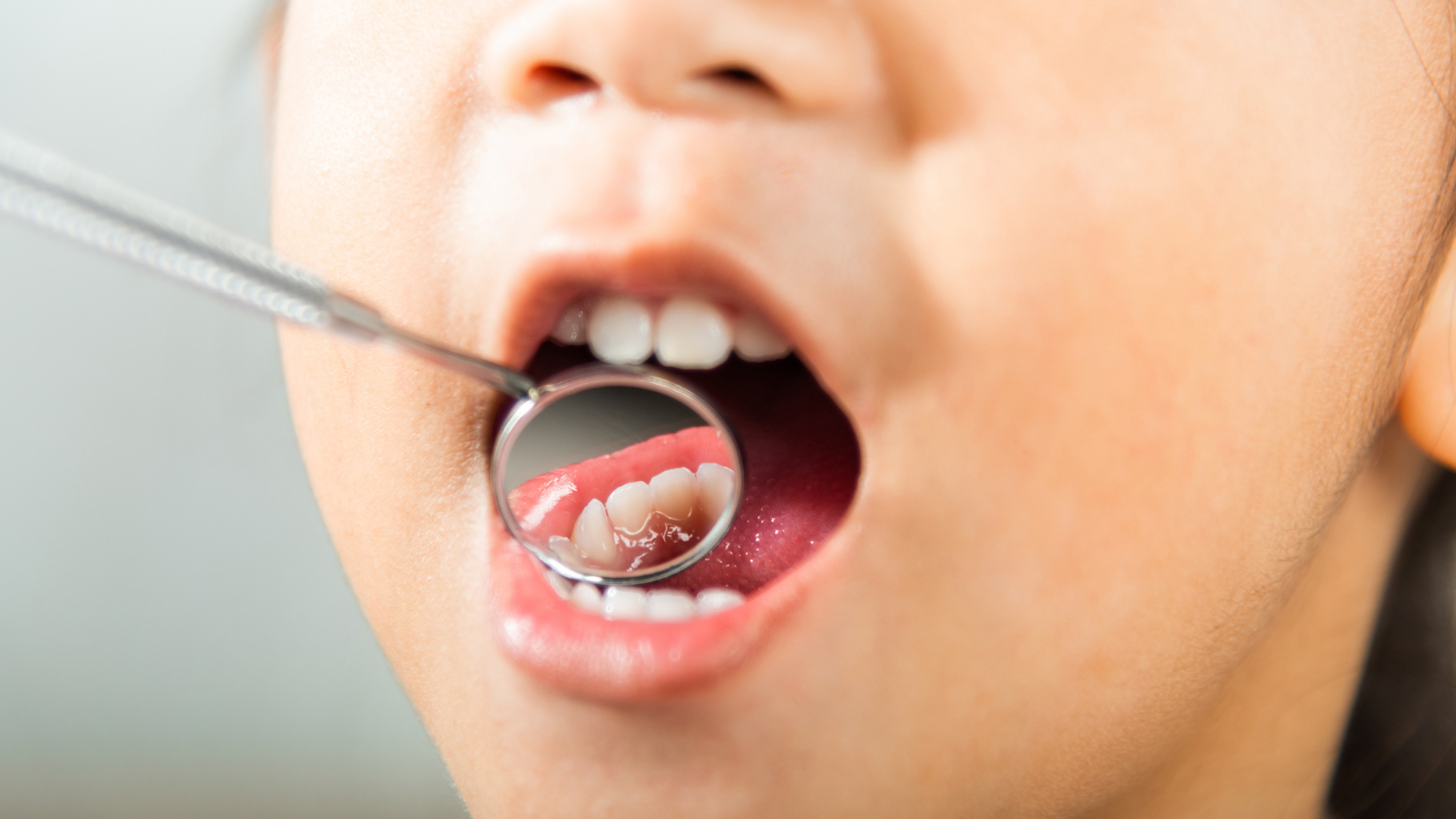 Kids teeth check up