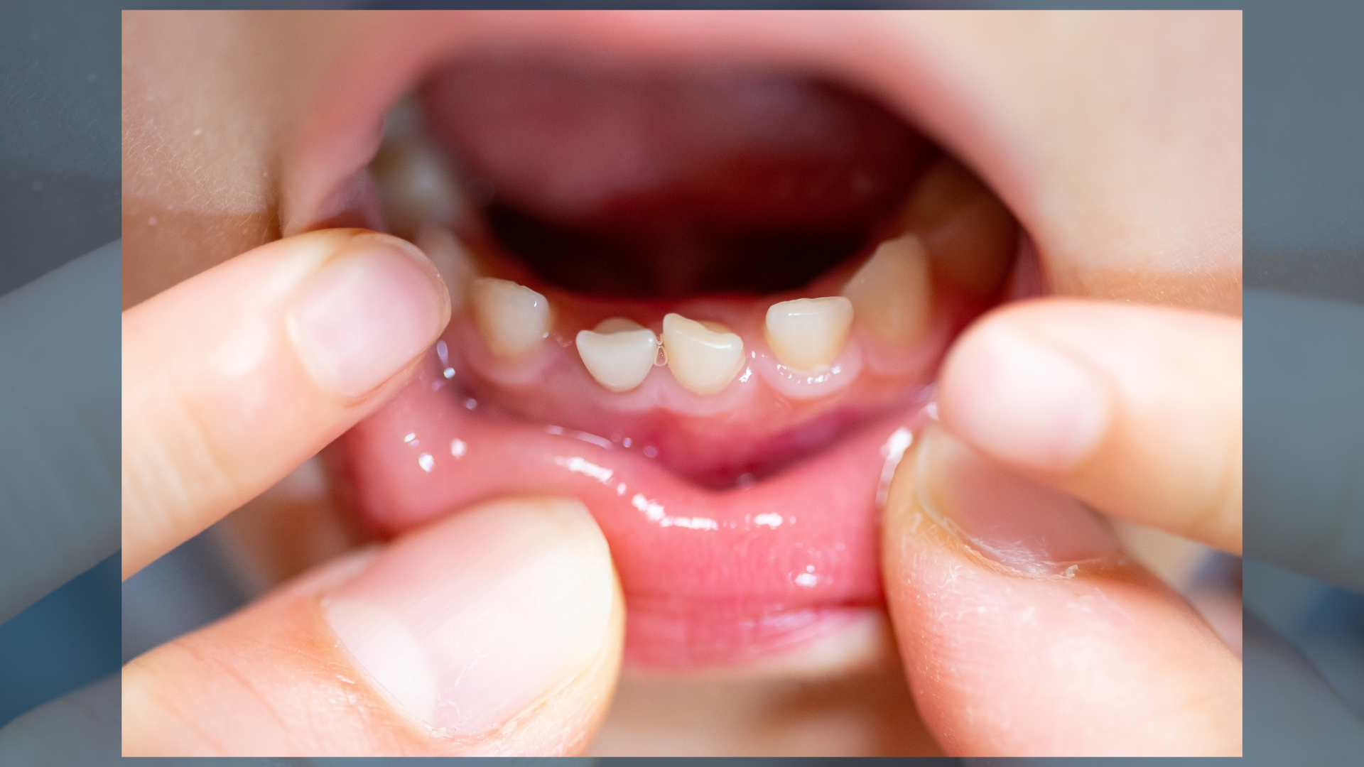 baby's teeth timeline
