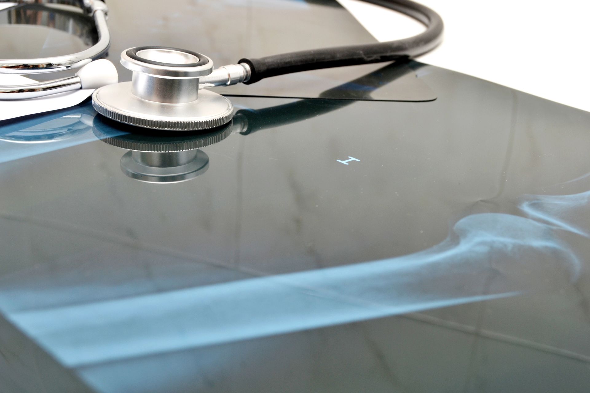 Lo stetoscopio poggia su una radiografia di un osso della gamba.